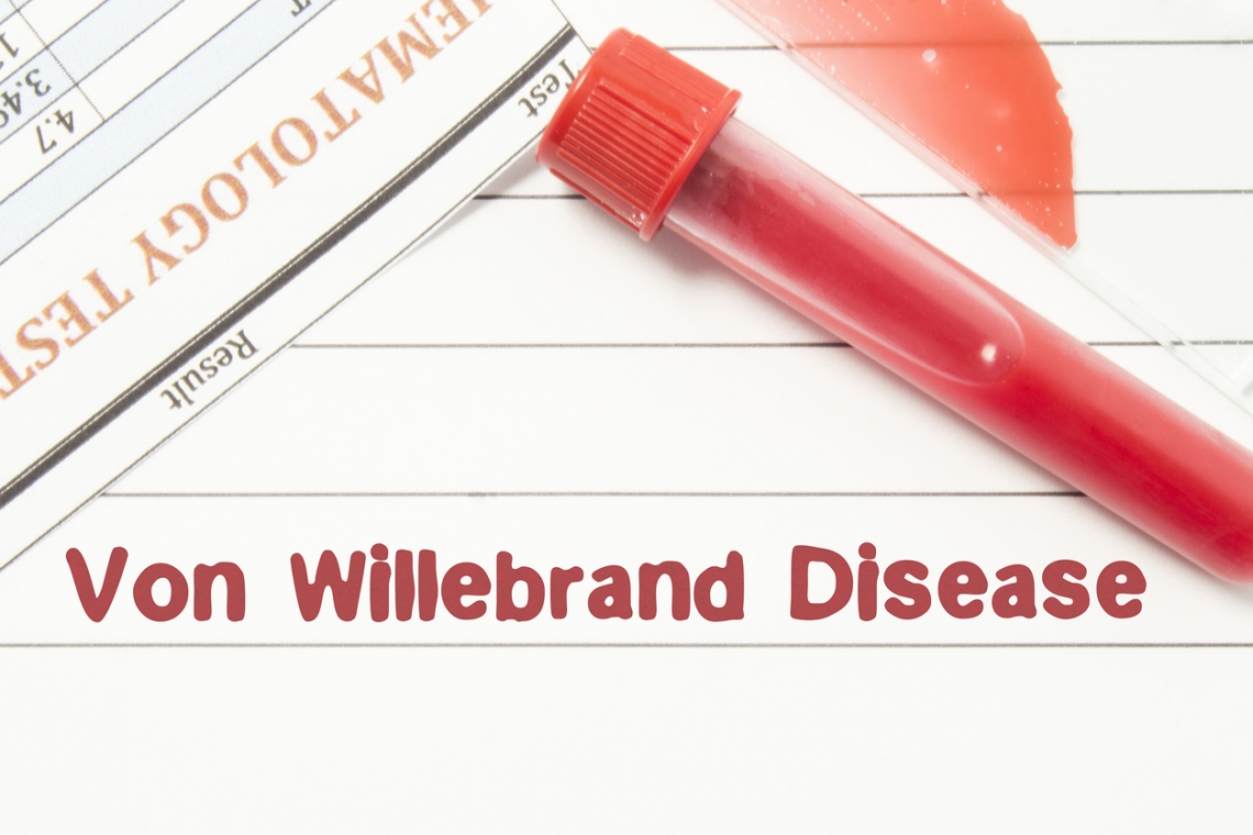 La malattia di Von Willebrand